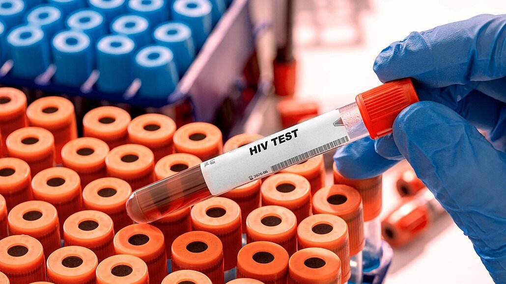 HIV v Česku dál přibývá. Případy nejsou jen ve velkých městech, týkají se i Moravskoslezského kraje