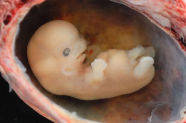 obrázek: Mikroplasty pronikají až do plodové vody, prokázal ostravský výzkum