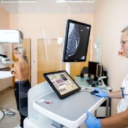 VZP v Jihočeském kraji zjednoduší preventivní mamografii bez žádanky