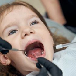 Dentobus odhalil kritický stav dětských zubů v Moravskoslezském kraji